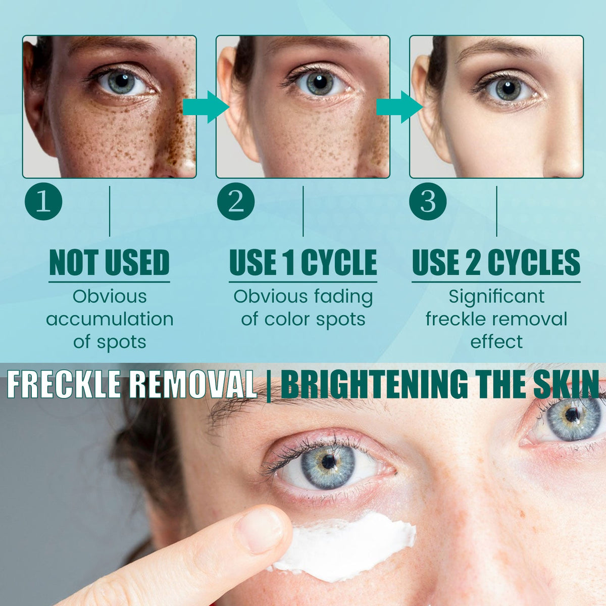 Dark Spot Cream for Face - Fades Freckles & Brightens