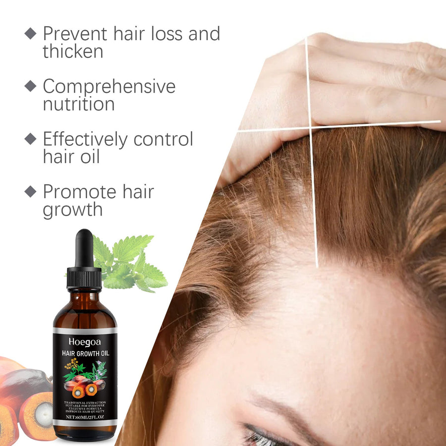 Rosemary Hair Growth Oil for Dry, Fragile Hair Care