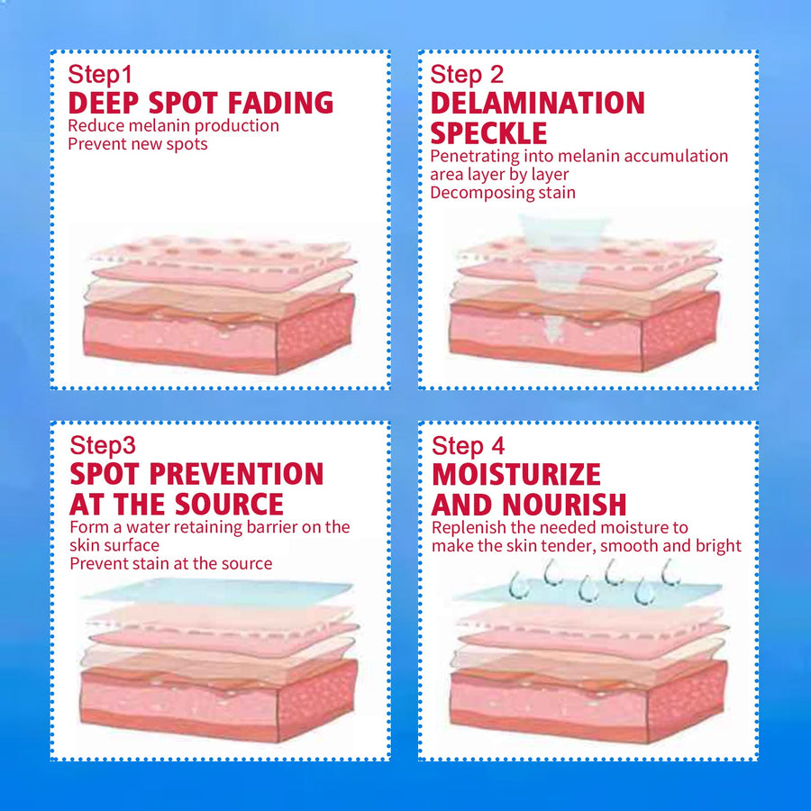 Melasma Cream For Dark Spots & Uneven Skin Tone