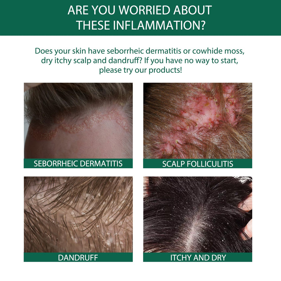 Scalp Serum for Dandruff and Follicle Relief