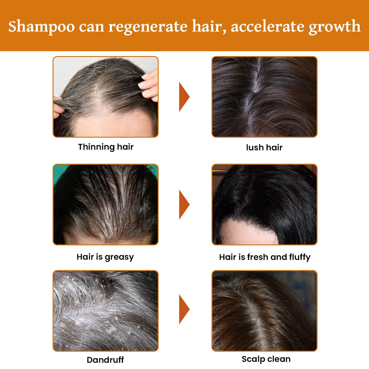 Rice Water Shampoo for Thicker, Stronger-Looking Hair