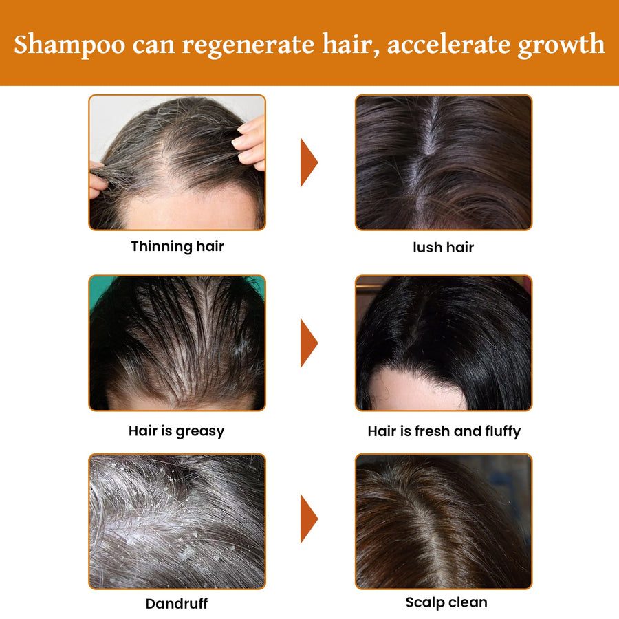 Rice Water Shampoo for Thicker, Stronger-Looking Hair