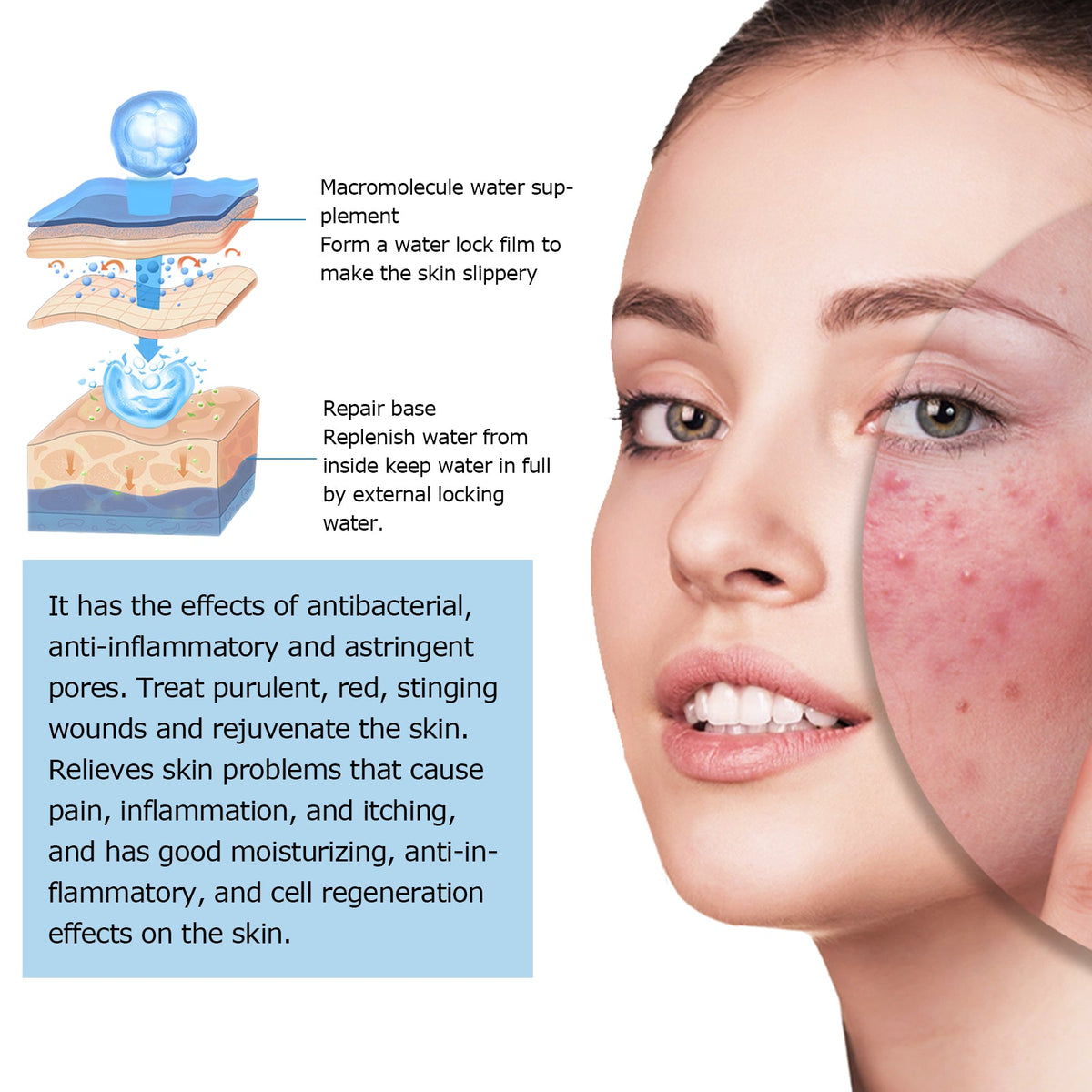 Hyaluronic Acid Serum for Acne Marks & Dry Skin