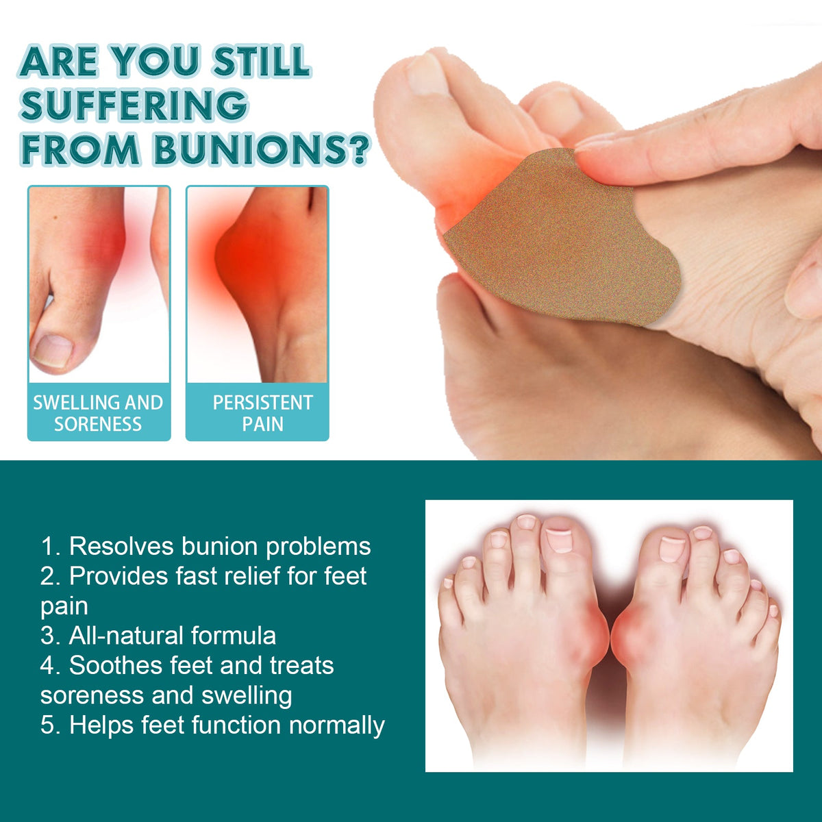 Bunion Relief Patch — Pain-Free Steps & Toe Alignment | EELHOE