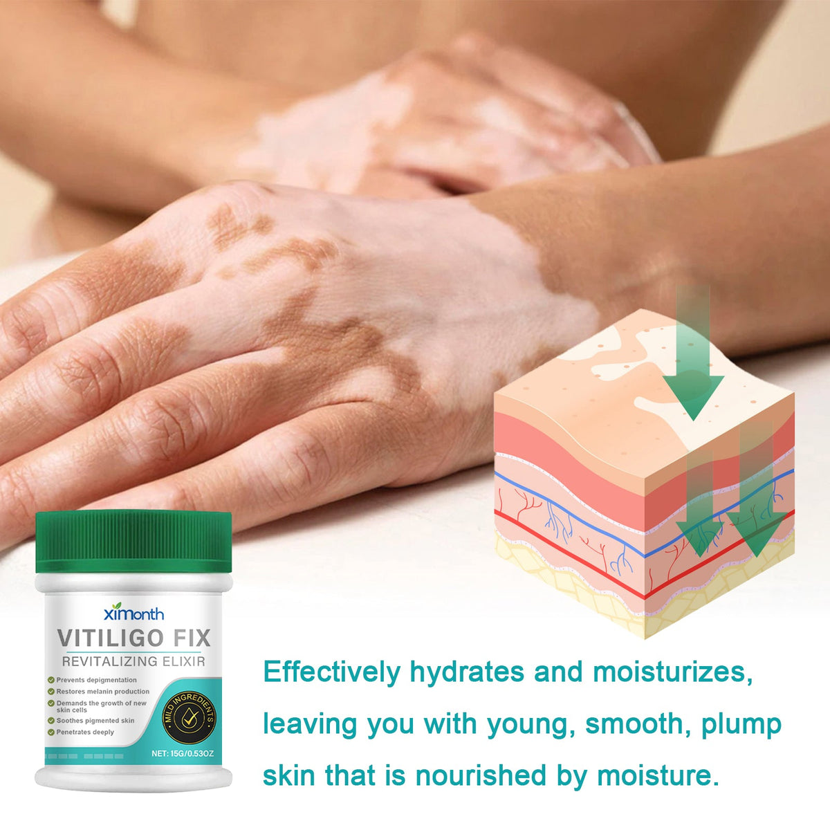 Vitiligo Fix Revitalizing Elixir, Lighten Skin Spots Even Sk