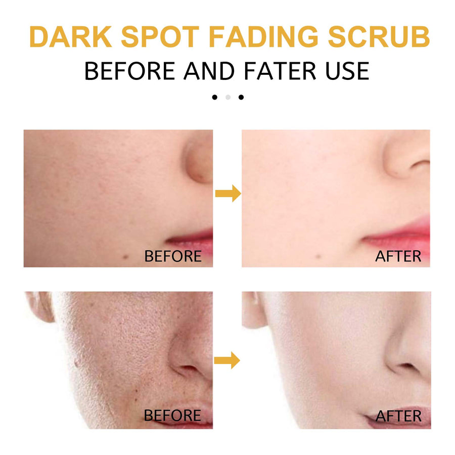 Turmeric Face Scrub for Dark Spots & Even Skin Tone