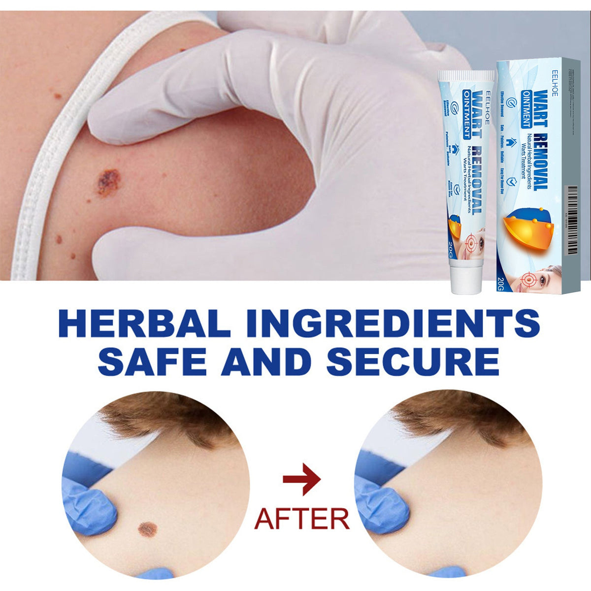 Keyu Cream Clean Skin Repair Care Body Face Remove Face Labe