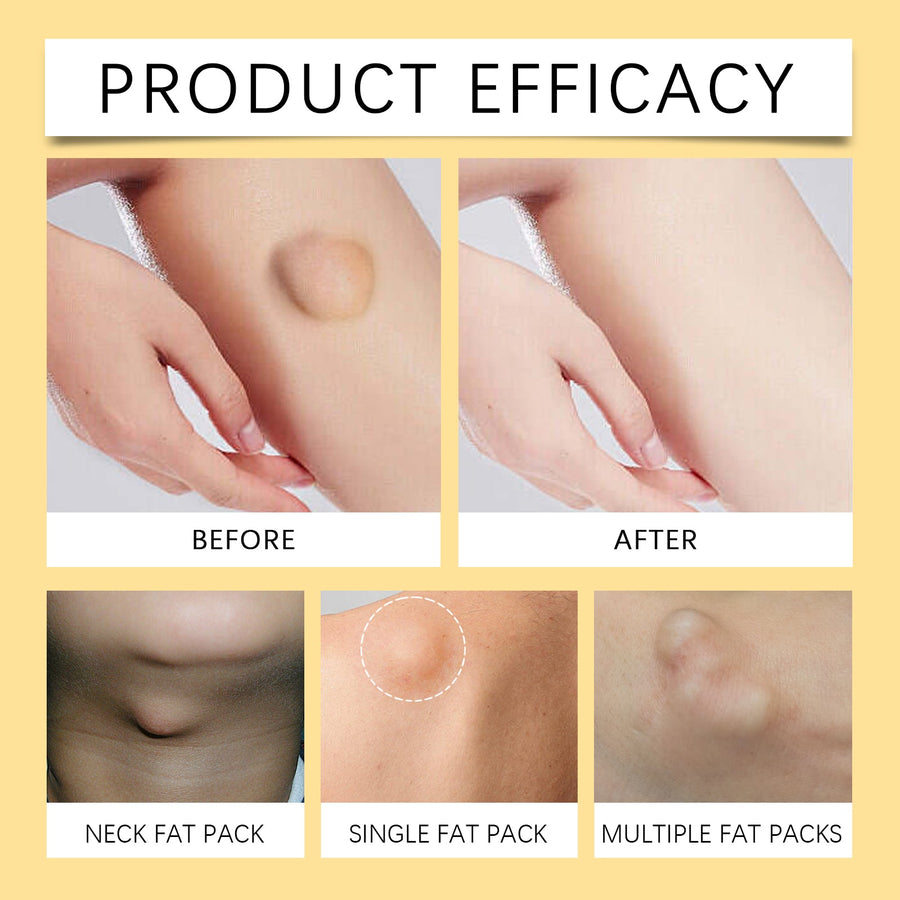 Bee Venom Fat Cream — Firms & Smooths Stubborn Body Areas