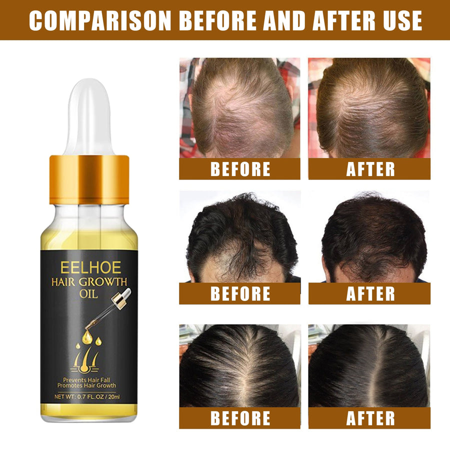 Hair Growth Oil for Fuller-Looking, Stronger Hair