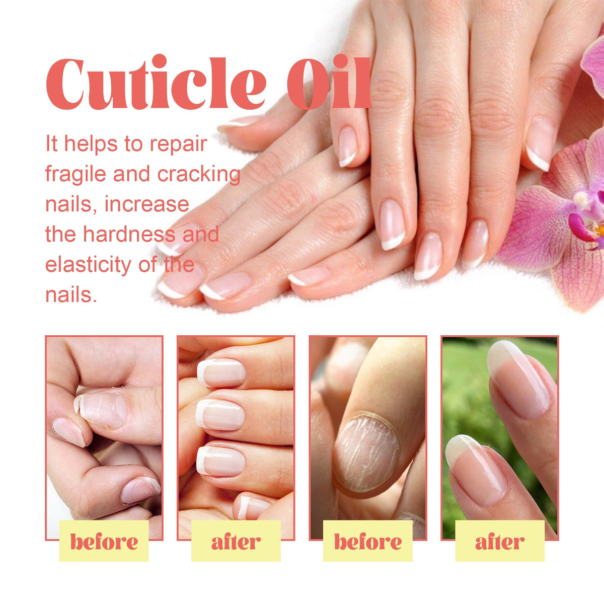 Cuticle Oil for Dry Rotted Nails & Cracked Cuticles