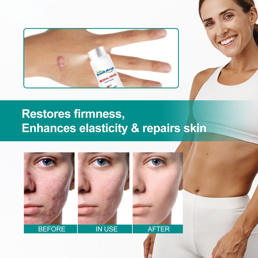 Medical Grade Scar Spray — Smooths & Fades All Scars | South Moon