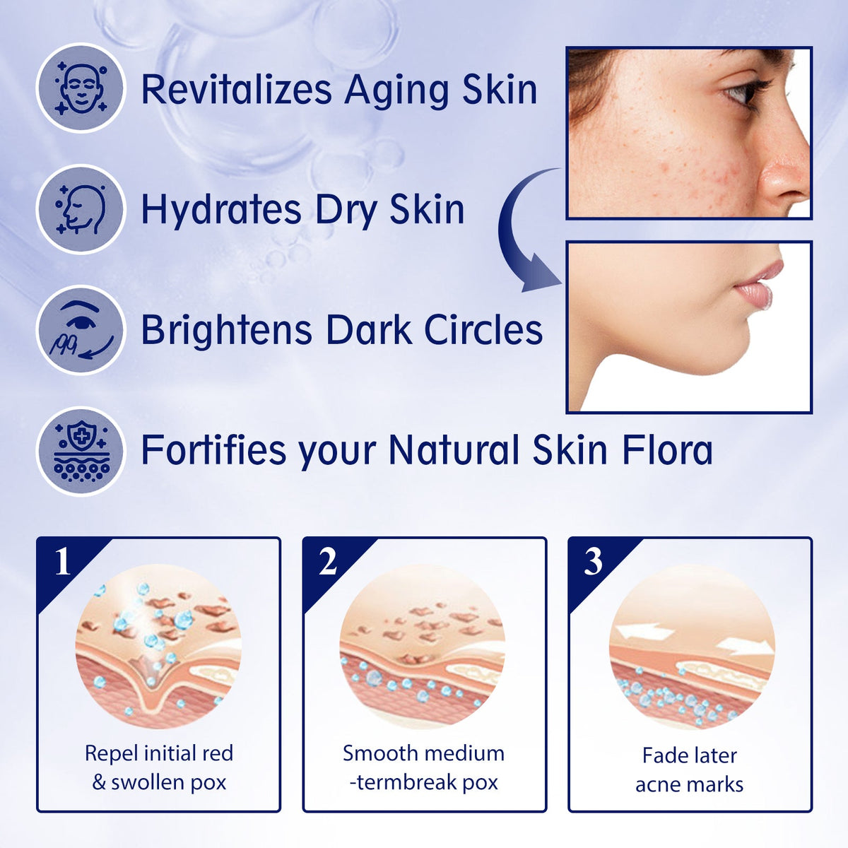 Vitamin C Facial Essence for Spots, Acne & Fine Lines