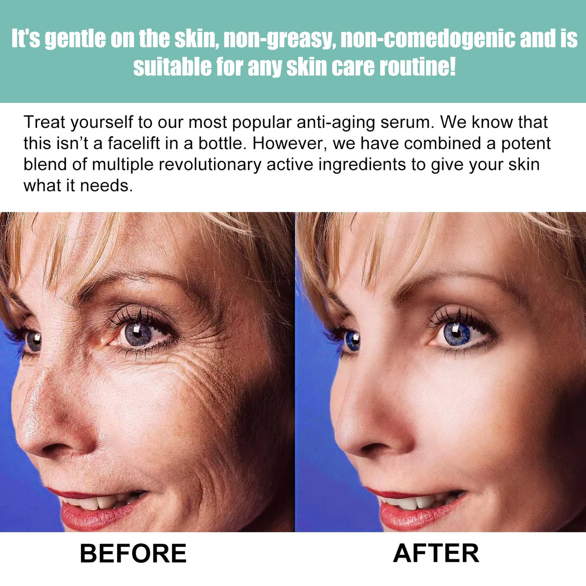 Anti-Wrinkle Serum for Fine Lines & Crow's Feet