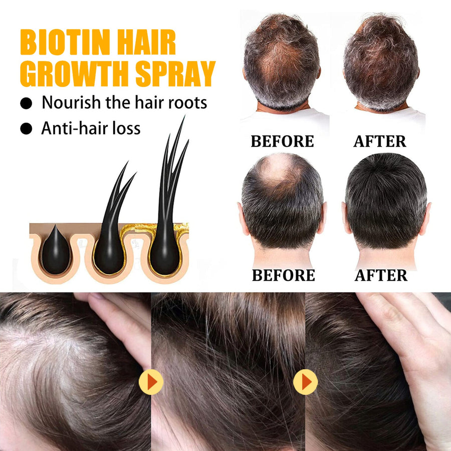 Biotin Hair Growth Serum — Stop Hair Loss, Visible Density