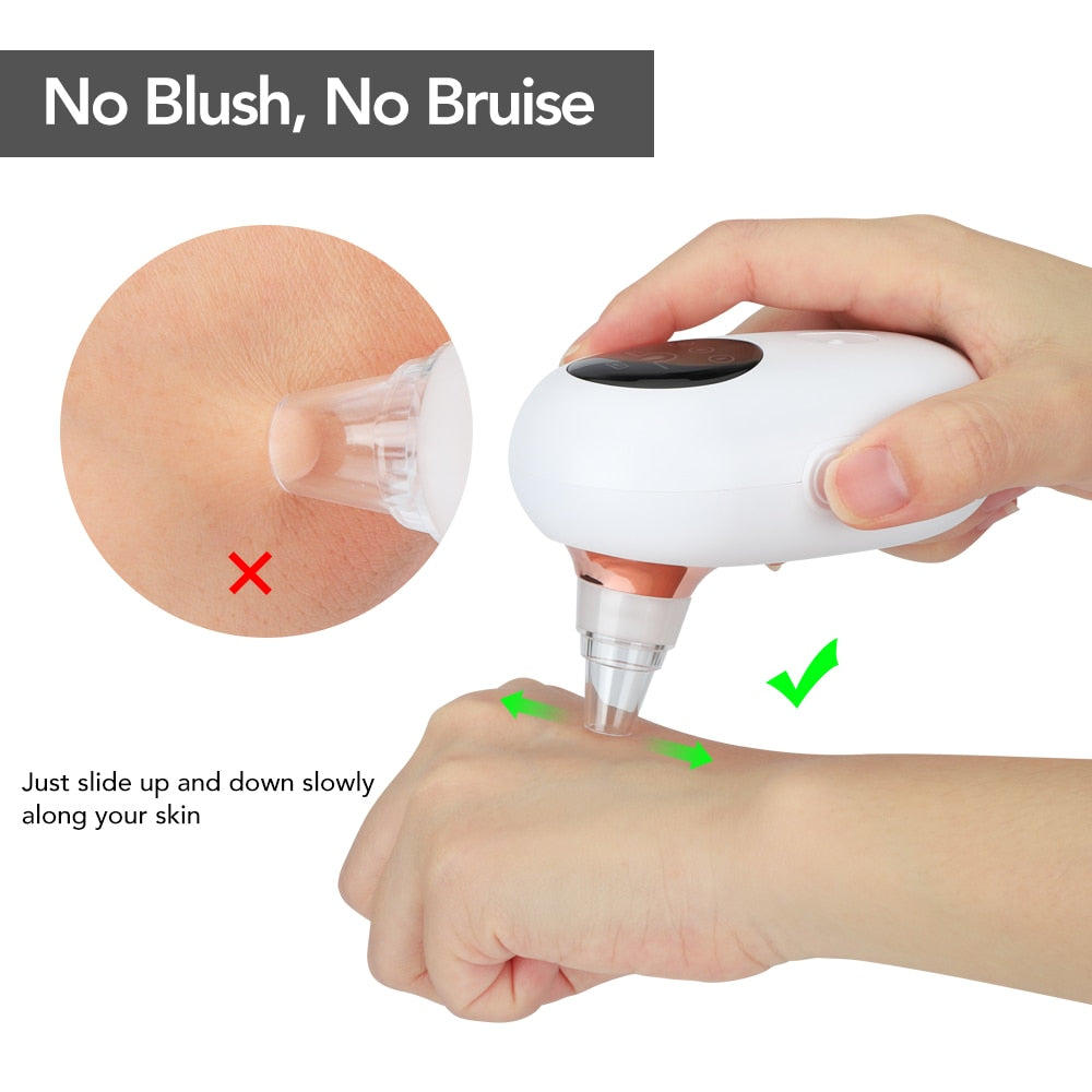 Facial Pore Vacuum Cleaner — Reduce Blackheads & Shrink Pores