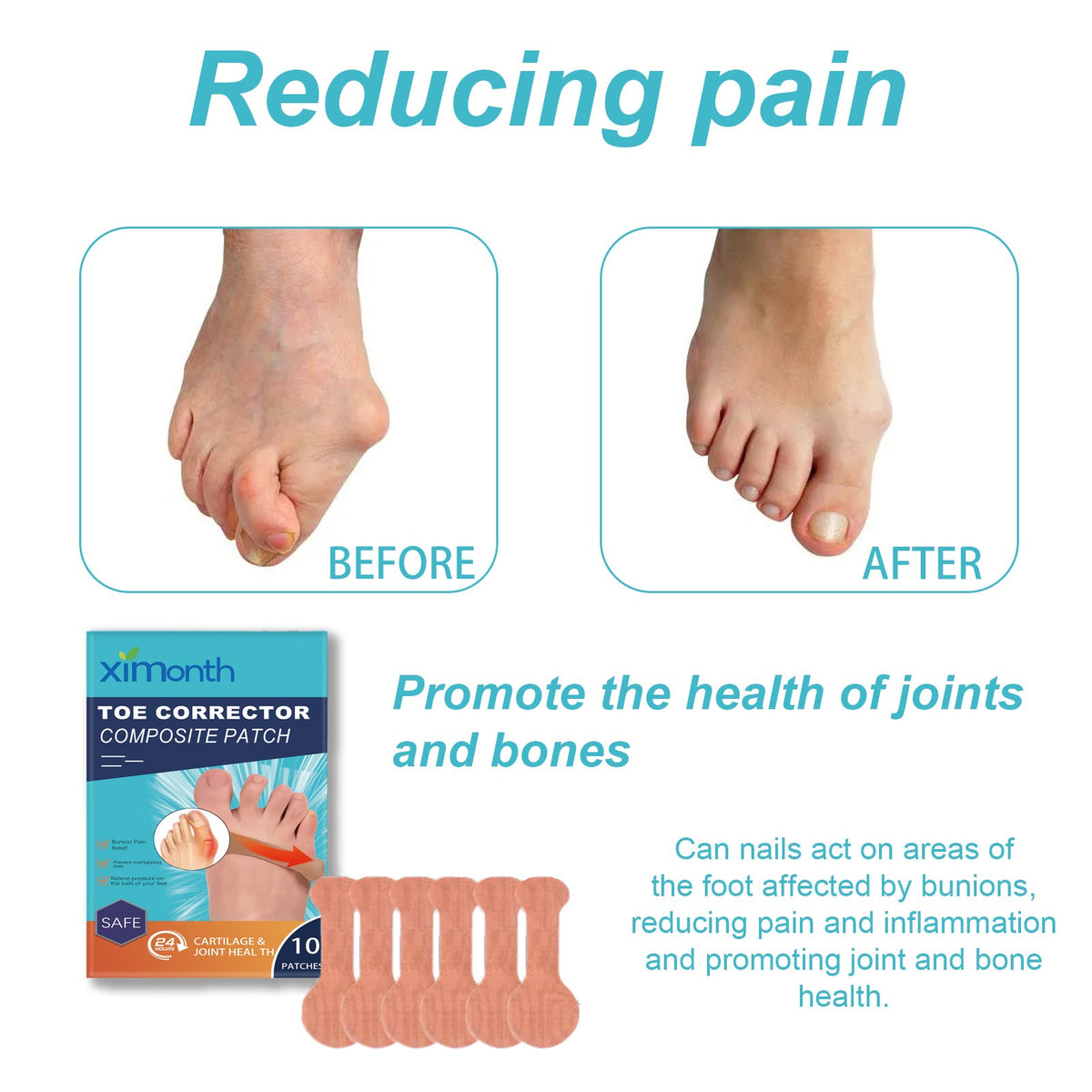 Bunion Corrector Patches for Big Toe Pain Relief