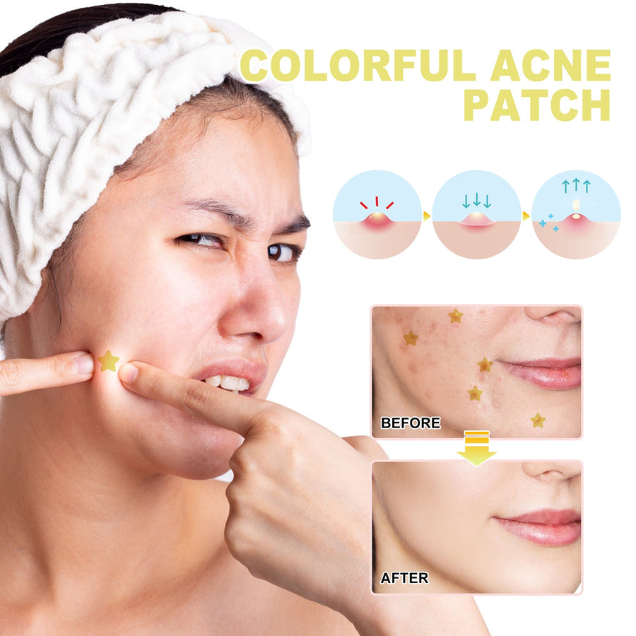 Colorful Acne Patches — Gentle Overnight Spot Treatment
