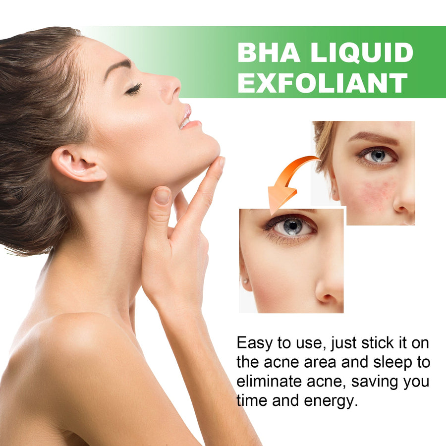 Overnight Acne Patches - Hydrocolloid Pimple Treatment