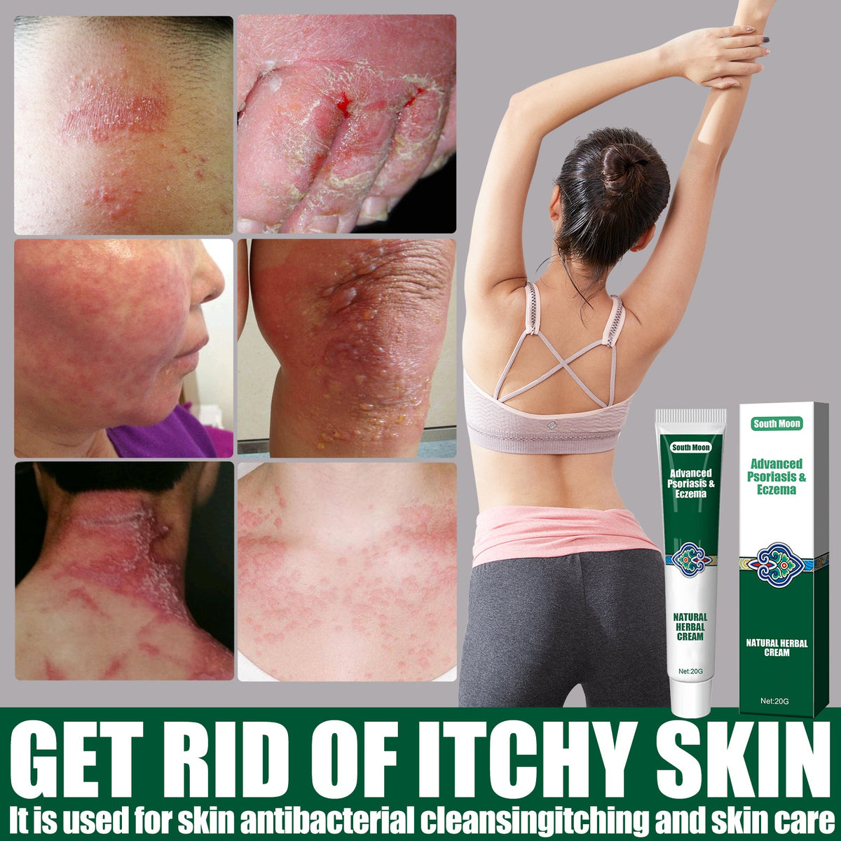 Herbal Soothing Cream for Dry, Itchy & Irritated Skin