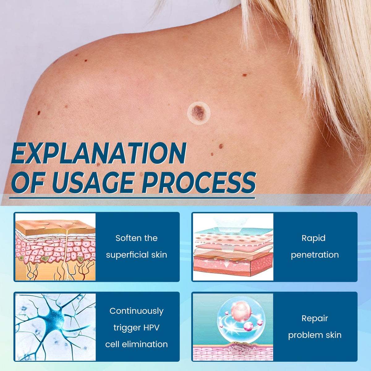 Skin Tag Patches with Natural Herbal Extract, 144 Ct