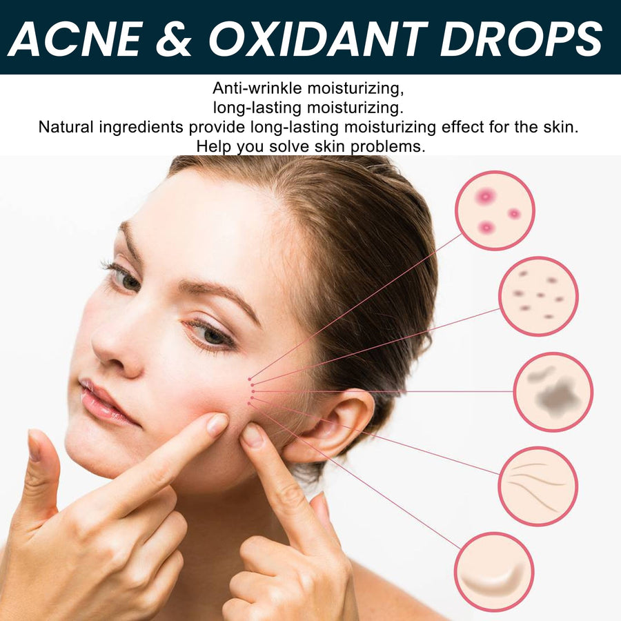 Acne & Oxidant Drops – Fade Pimples, Restore Radiance