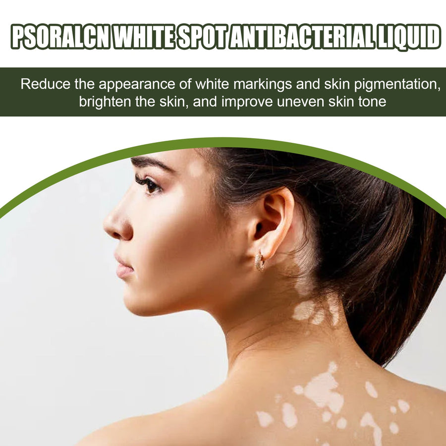 White Spot Purifying Serum – Brighten Uneven Skin Tone