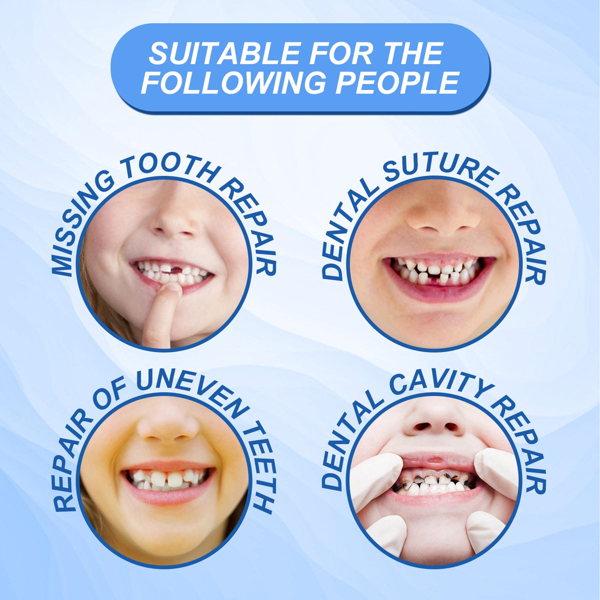 Temporary Tooth Filling Kit — Realistic DIY Smile Repair