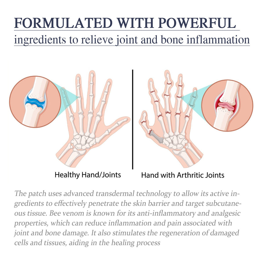 Bee Venom Joint Cream - Fast-Acting Bone & Joint Relief