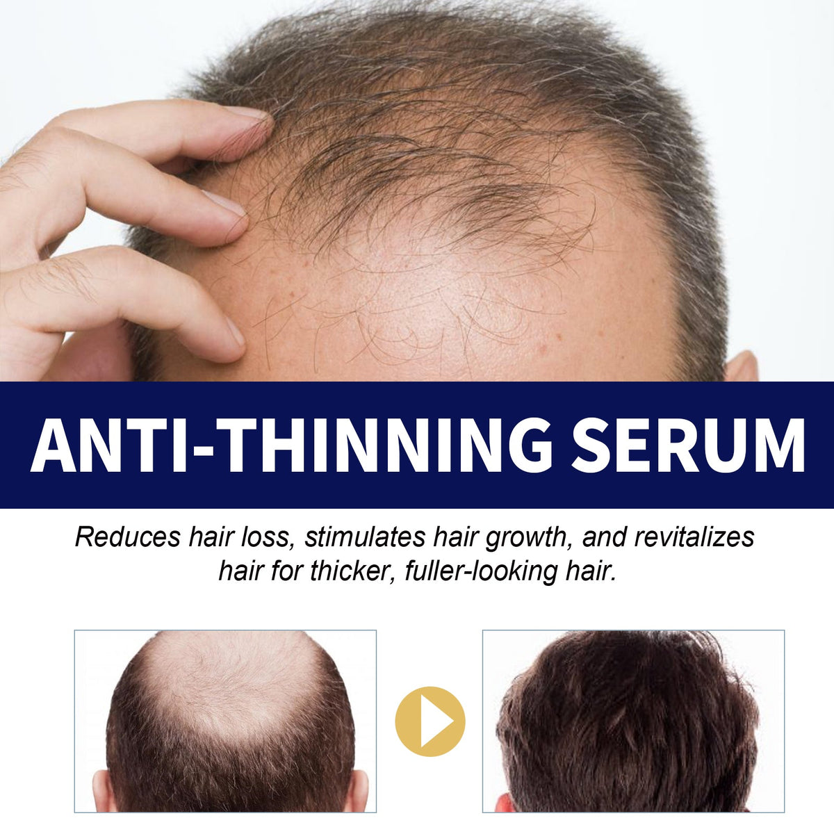 Anti-Thinning Hair Serum for Thicker-Looking Fuller Hair