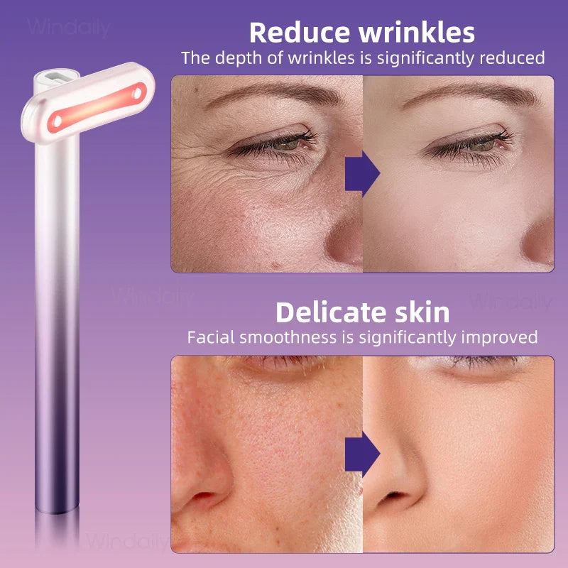 Facial Lifting Wand — 4 Therapies in 1 for Firmer, Youthful