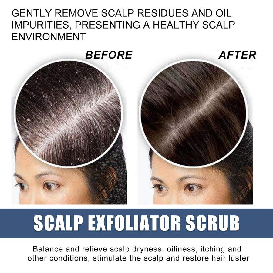 Scalp Exfoliating Scrub — Fresher Roots, Softer Feel