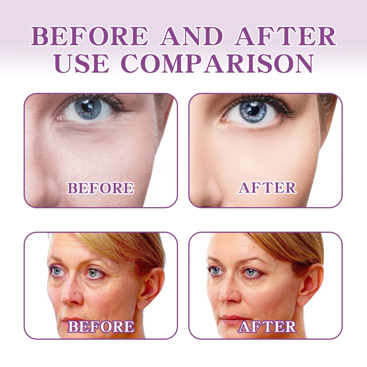Facial Lift Patches for Fine Lines & Firmness