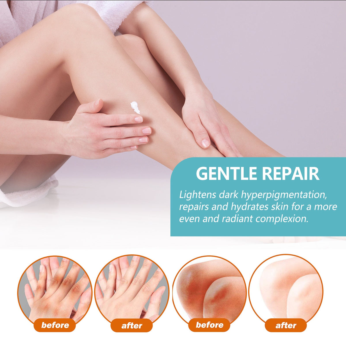 Dark Spot Repair Cream for Underarms, Elbows & Knees