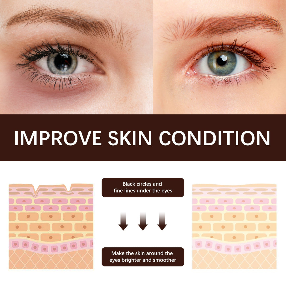 Retinol Eye Cream for Wrinkles, Dark Circles & Puffiness