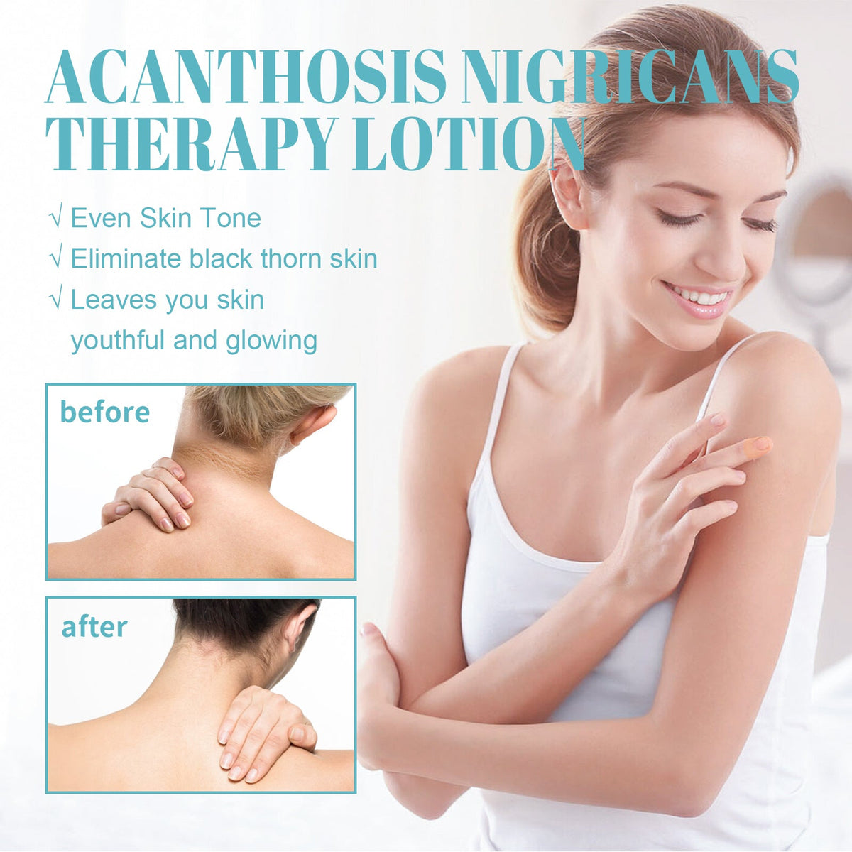 Acanthosis Nigricans Therapy Lotion for Dark Skin Patches