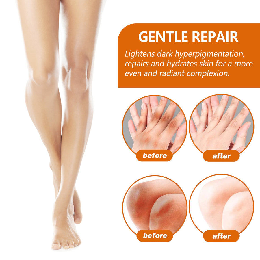 Acanthosis Nigricans Repair Essence, Brightening Skin Repair