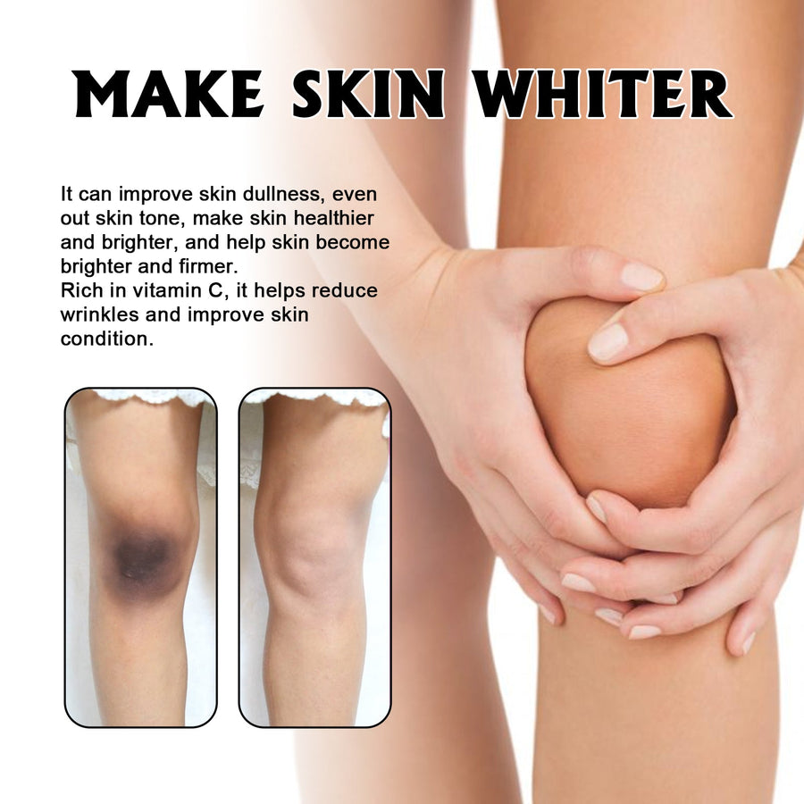Glutathione Vitamin C Serum for Dark Spots & Elbows