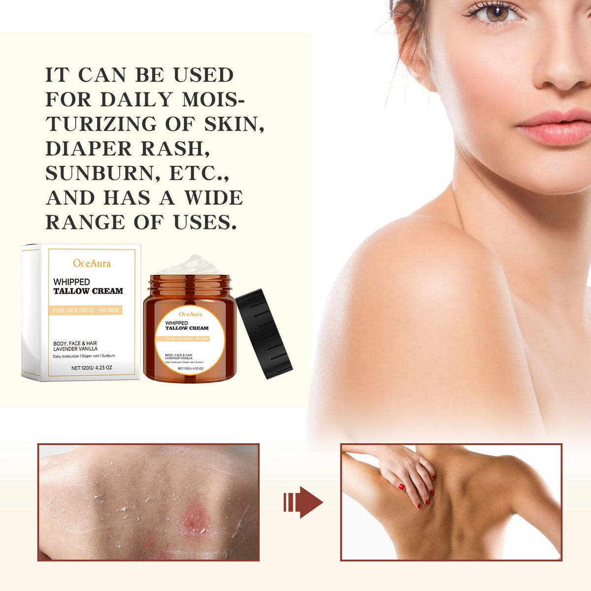 Whipped Tallow Cream for Dry, Cracked & Itchy Skin