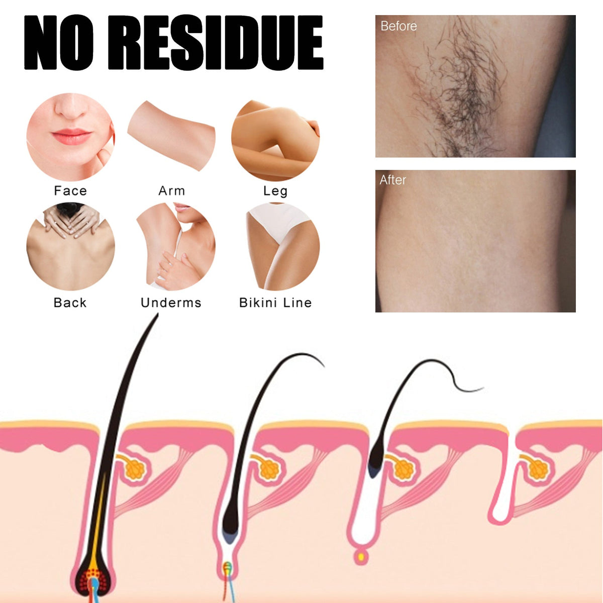 Underarm Refreshing Hair Removal Spray - Gentle Smooth Skin