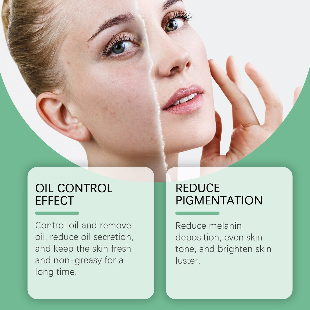 Azelaic Acid 10% Cream for Oily, Uneven-Tone Skin