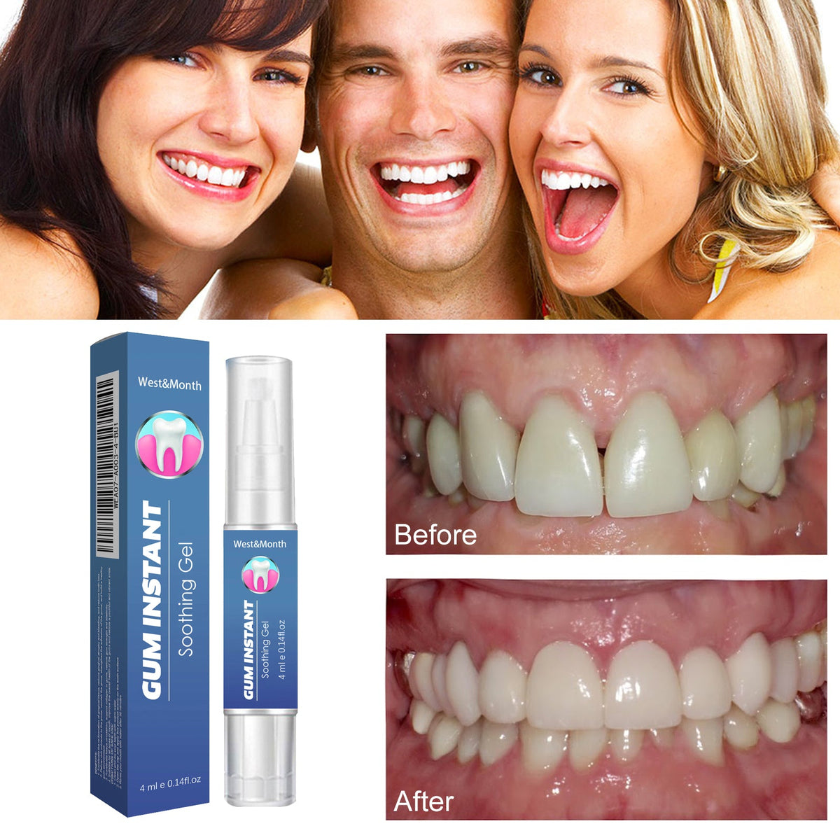 Gum Pain Relief Gel with Whitening — Instant Soothing