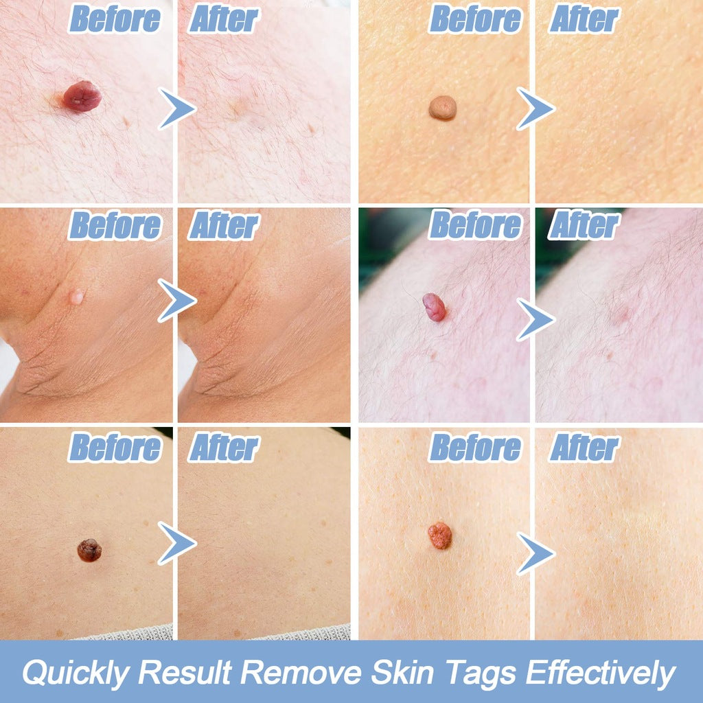 Gentle At-Home Skin Care Device