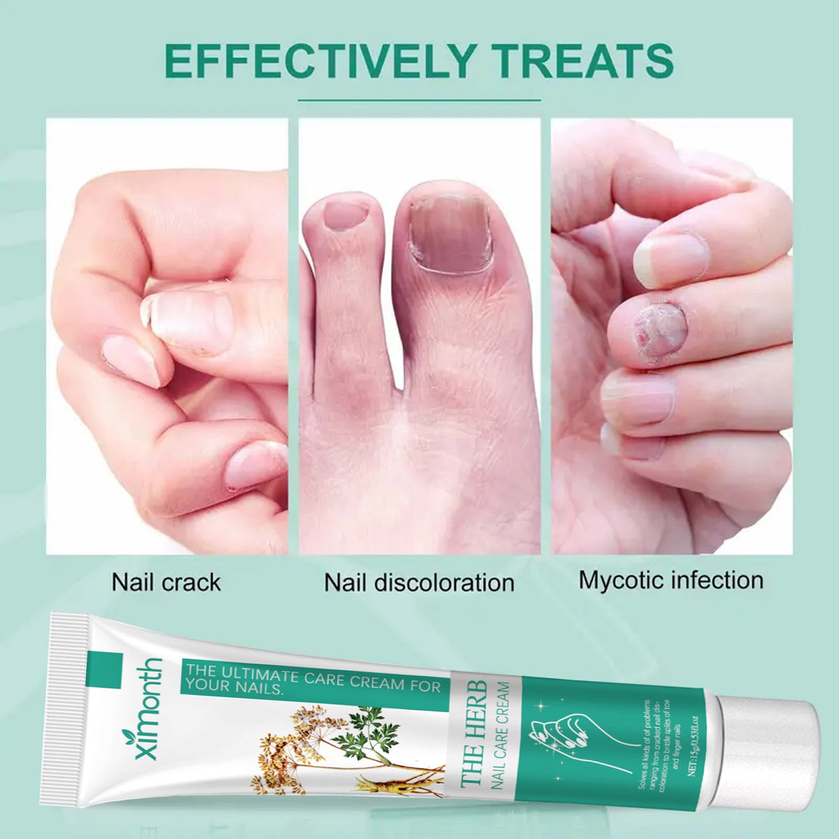 Nail Repair Cream for Grey, Brittle & Thickened Nails