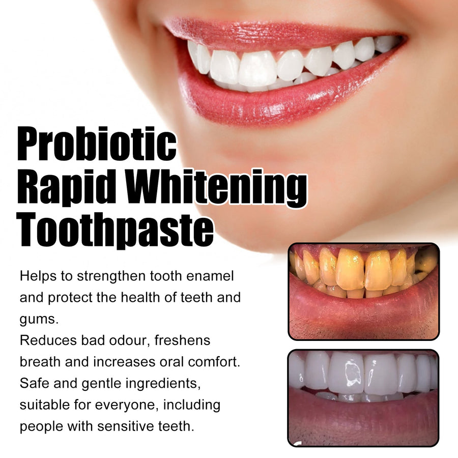 Probiotic Whitening Toothpaste — Rapid Whitening & Gum Comfort