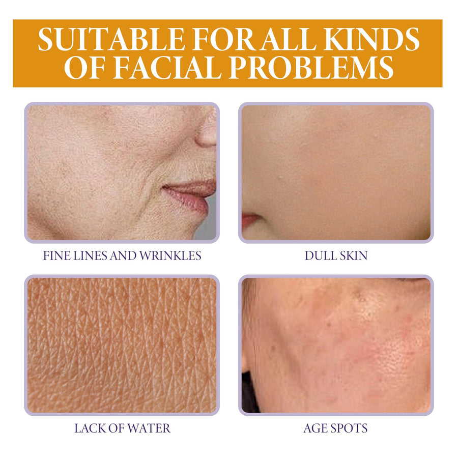 Vitamin C Serum for Age Spots & Wrinkles, Firming