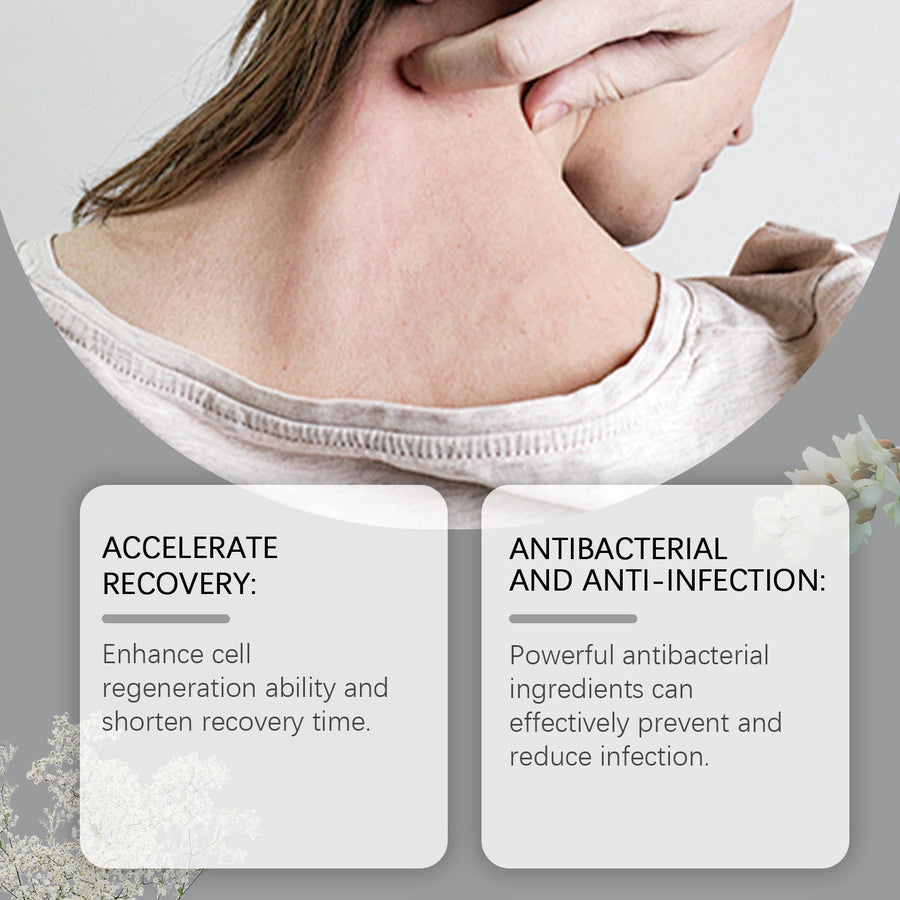 Diabetic Bedsore Cream — Herbal Antibacterial Healing