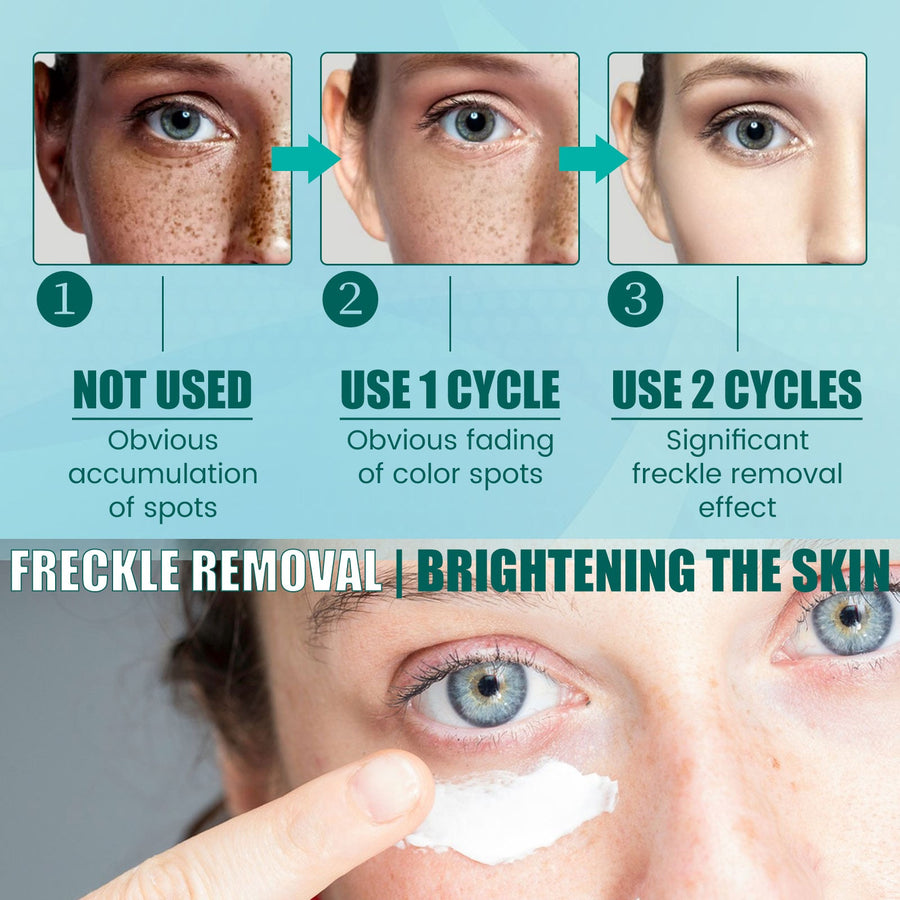 South Moon Spot Cream for Dark Spots & Uneven Tone