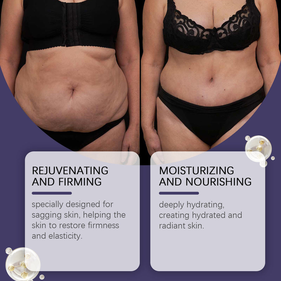 Coffee Retinol Body Firming Cream for Sagging Skin
