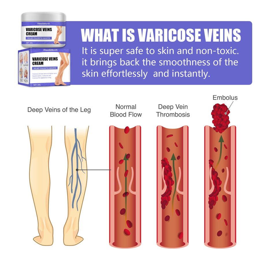 Varicose Veins Cream — Reduces Vein Visibility & Leg Discomfort
