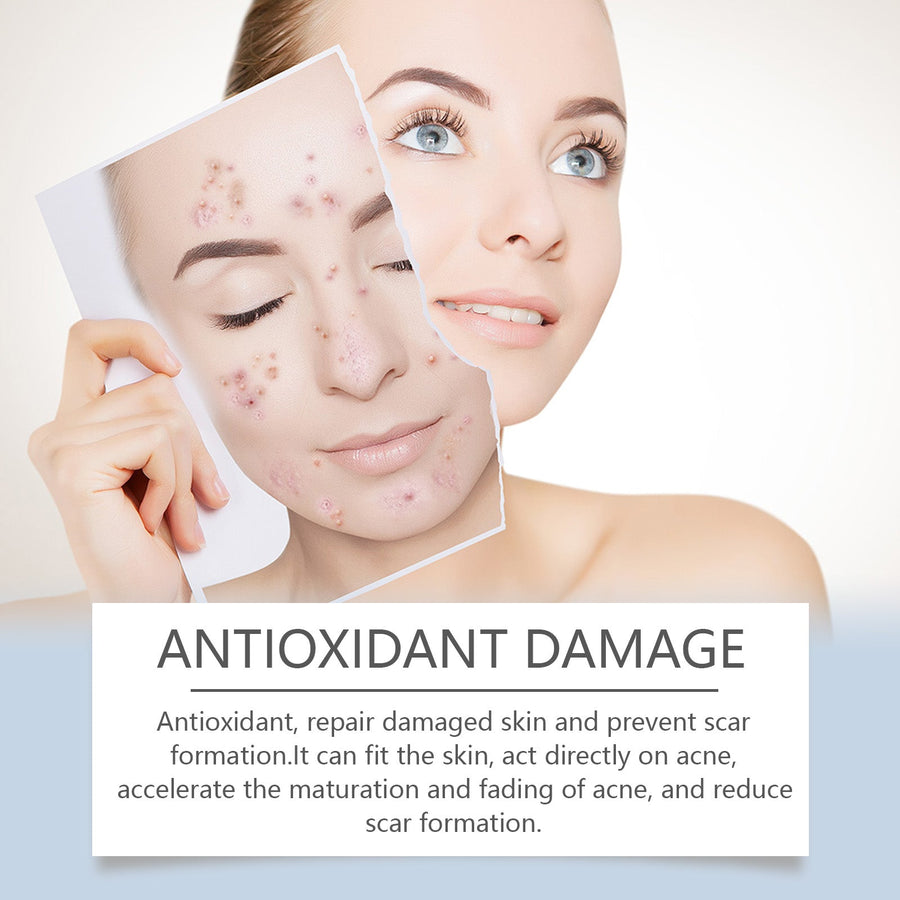 Invisible Acne Patches - Overnight Zit Absorb, 240 Ct